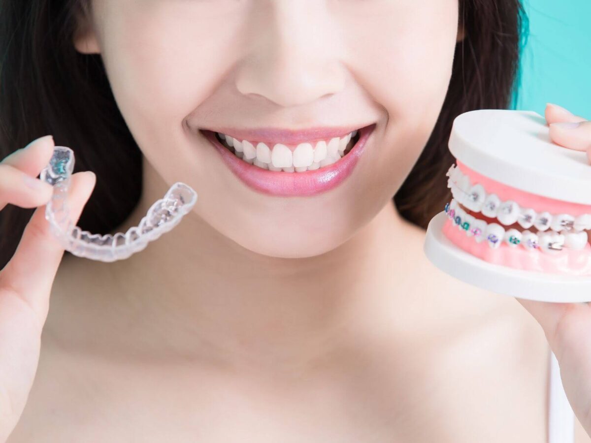 Invisalign Alternatives: What You Should Consider